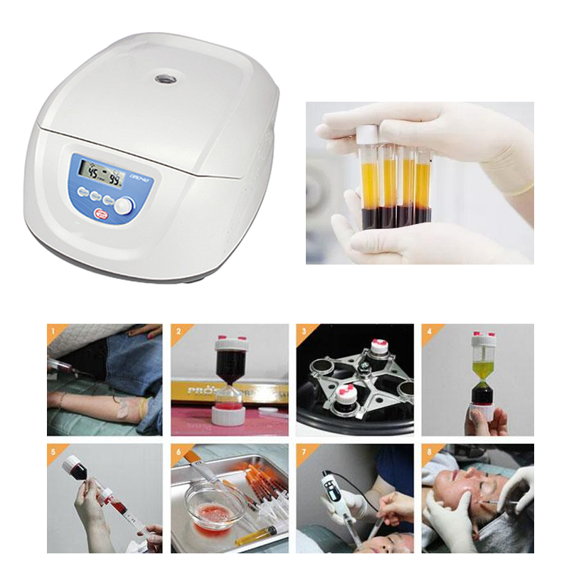 Medical Lab Center - Bestseller Medizinische Blut-PRP-PRF-CGF-Zentrifuge für 5ml 10ml